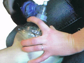 В Украине начинают использовать новую маску для поддержки дыхания