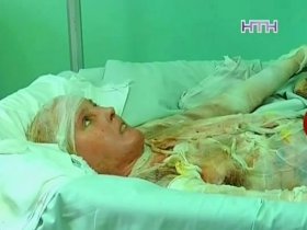 На Донеччині жінка постраждала від вибуху природного газу у ванній кімнаті