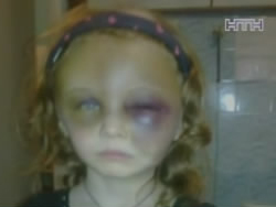 В Донецке мать-психопатка зверски избила дочку