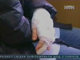 В Полтаве подозрительная на бешенство псина покусала 43 человек