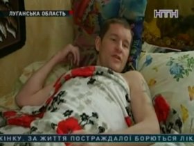 Руководство шахты, на которой был покалечен 34-летний шахтер, лишает его законных выплат на лечение