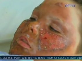 В Донецкой области 11-летний парень едва не погиб на железнодорожной станции