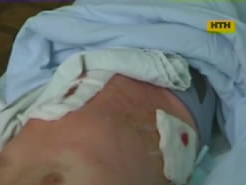 У Херсоні студенти напали на правоохоронців