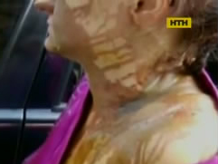 Милиция разыскивает киевлянина, который облил жену кислотой