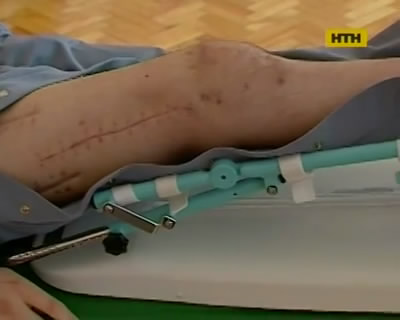 Для пострадавших в АТО открыли центр реабилитации