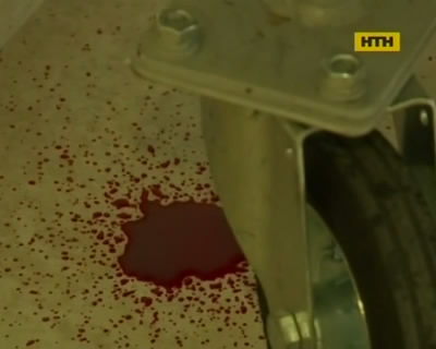 На Винничине врач зарезал старшего коллегу