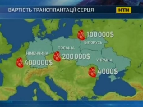 Закони та забобони заважають робити трансплантацію серця в Україні