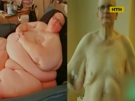 Англійця покинула кохана, заради якої він схуд на 300 кг