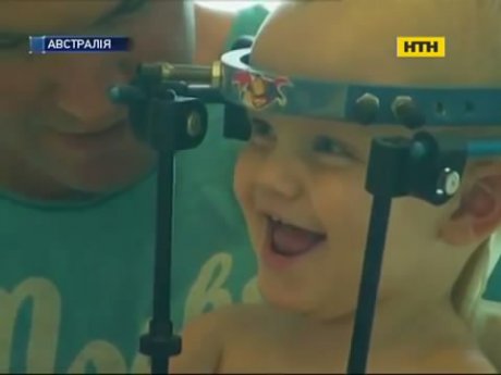 В Австралії успішно прооперували малюка зі зламаною шиєю
