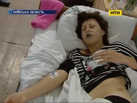 На Киевщине бывший милиционер покалечил беременную женщину
