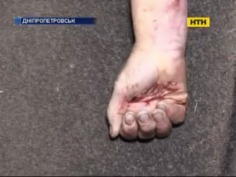 У Дніпропетровську пенсіонер по-звірячому вбив дружину