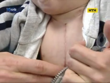 Столичные хирурги спасли мальчика с уникальной патологией сердца