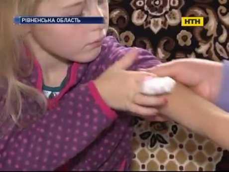 Спалах сказу на Рівненщині