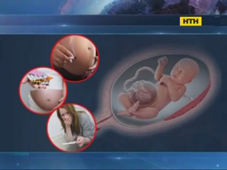 Столичні дитячі хірурги рятують немовлят зі страшною патологією
