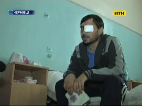 У Чернівцях вогняна забавка коштувала містянину ока