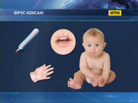 Новий вірус вразив малюків на Тернопільщині