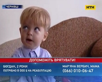 Рідні 2-річного Богданчика з Чернівців мріють почути його перше слово