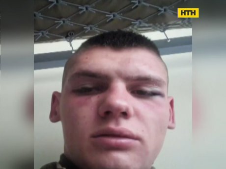 У Львові розслідують жорстоке побиття курсанта