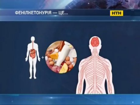 Медицина, якої немає - фенілкетонурія