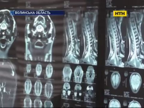 З'ясували, що хлопчик на Волині помер не від поліомієліту