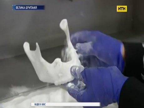 Новое слово в восстановительной хирургии - 3D-печать