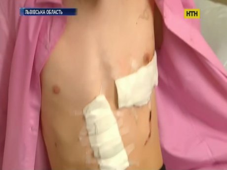 В районной больнице во Львовской области спасли подростка с пробитым сердцем
