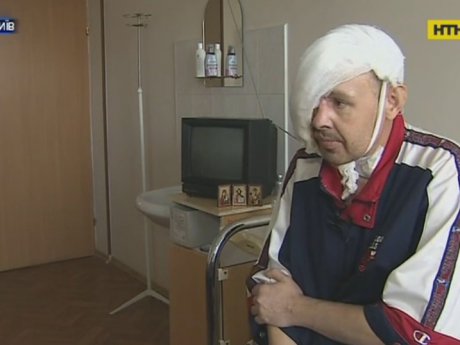 В Институте Шалимова медикам удалось пересадить пациенту пол-лица!