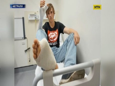 Уникальную трансплантацию провели в Австралии