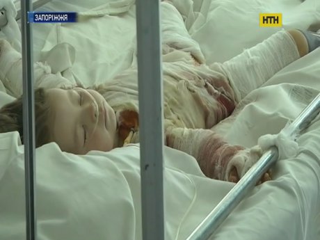 Запорожские медики пытаются спасти девочку, которая подожгла на себе одежду