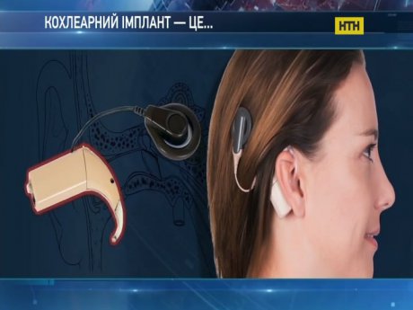 Глухі діти не отримують фінансування на реабілітацію
