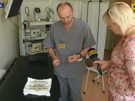 В Ровно медики коллекционируют предметы, которые вытащили во время операций из тел украинцев