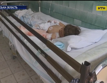 10-летнего мальчика ударило током в 10 тысяч вольт в Черкасской области
