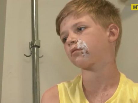 В Одесі чоловік облив 12-річного хлопчика кислотою