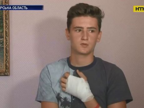 На Житомирщині підліток кинувся рятувати дівчину, яку посеред вулиці бив агресивний чоловік