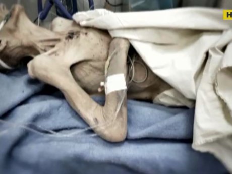 В Днепре страшной смертью умерла пенсионерка, которую до ужасного состояния довел сын