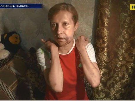 На Харьковщине жестоко избили и изнасиловали 52-летнюю женщину у нее дома