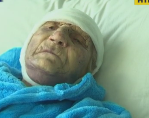 В Житомирской области жестоко ограбили пенсионерку