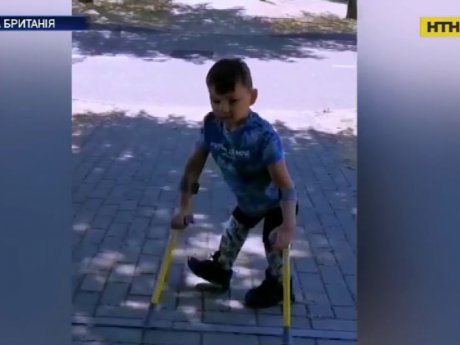 5-річний хлопчик, якому ампутували обидві ноги, зібрав більше мільйона доларів для лікарні