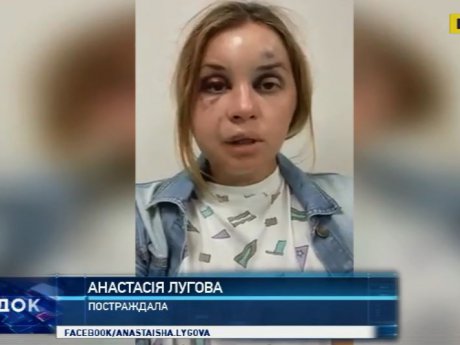 На редактора телеканала Интер совершено жестокое нападение в купе поезда Мариуполь-Киев