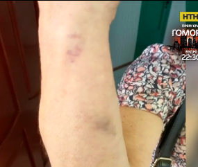 В Сумах женщина избила кондуктора троллейбуса из-за просьбы надеть защитную маску