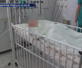 5-летний мальчик наглотался воды для чистки труб и чуть не умер на Днепропетровщине