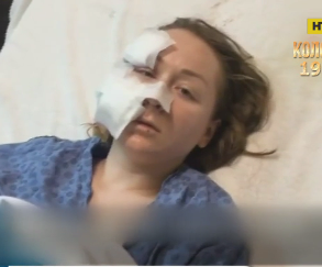 Українці порізали обличчя ножем в Туреччині