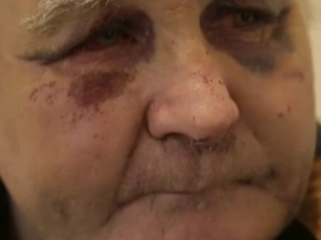 На Буковине 5 мужчин жестоко избили пенсионера