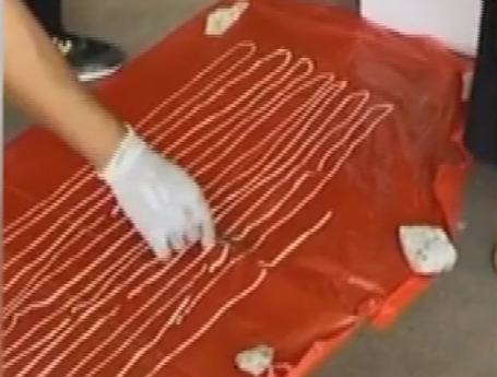 Вісімнадцятиметрового глиста виявили у мешканця Таїланду