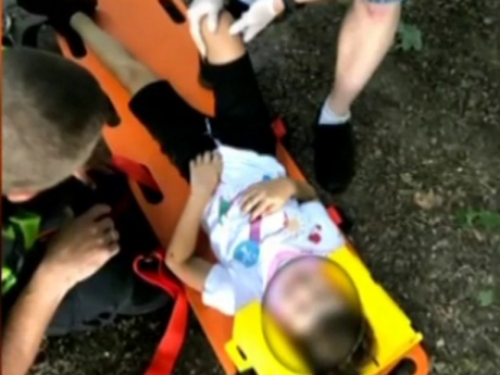У Львові медики рятують життя 8-річному хлопчику, який дістав перелам черепа під час прогулянки в парку