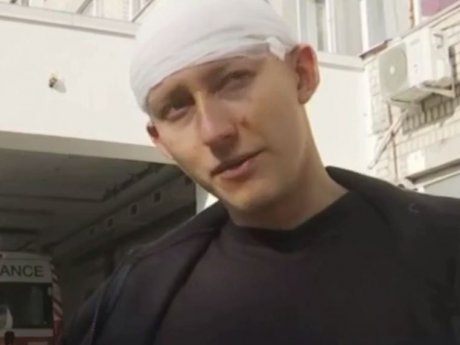 В Николаеве молодой человек, вышел из дома, стал боксерской грушей для целой толпы нападавших в масках