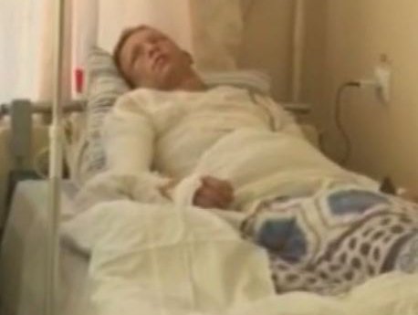Хмельницкие медики спасают жизнь 16-летнего парня из села Мартыновки, который попал в больницу с ожогами лица, шеи и туловища